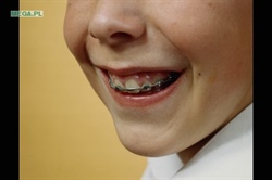 Skwierzyna, Dentysta, gm.Skwierzyna, woj.lubuskie